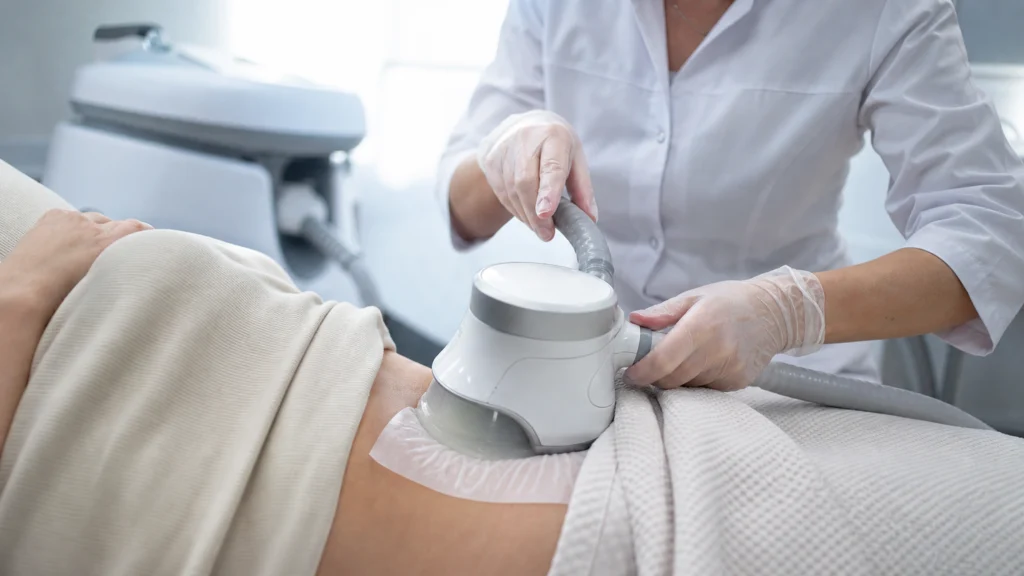 Séance de cryolipolyse avec applicateur posé sur le bas-ventre